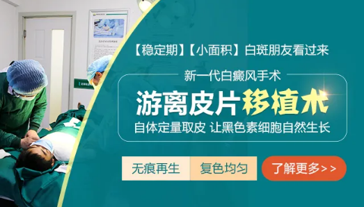 成都白癜风医院哪个好