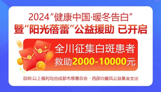 成都治疗白癜风医院